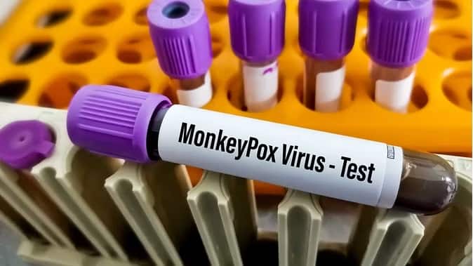 Monkeypox: Monkeypox is also spread through sexual relations, World Health Organization also confirmed. Monkeypox:સેક્સ્યુઅલ રિલેશનથી પણ ફેલાઇ છે મંકીપોક્સ, WHOએ કરી પુષ્ટી
