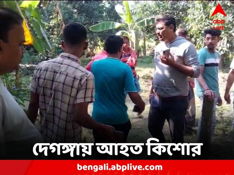 North 24 Parganas News Deganga While playing with the ball teenager was injured North 24 Parganas News: বল ভেবে খেলতে গিয়ে বিপত্তি, বোমা ফেটে জখম কিশোর