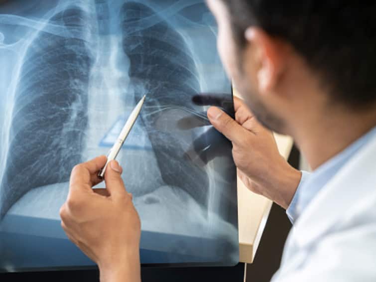 Tips To Take Care Of Your Lung Health In Kids To Prevent Pneumonia How To Take Care Of Your Lung Health This Winter To Prevent Pneumonia? See What Experts Say
