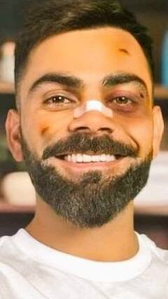 virat की चोट देख fans हुए परेशान