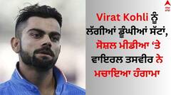 Virat Kohli: ਵਿਰਾਟ ਕੋਹਲੀ ਨੂੰ ਲੱਗੀਆਂ ਡੂੰਘੀਆਂ ਸੱਟਾਂ, ਸੋਸ਼ਲ ਮੀਡੀਆ ਤੇ ਵਾਇਰਲ ਤਸਵੀਰ ਨੇ ਮਚਾਇਆ ਹੰਗਾਮਾ
