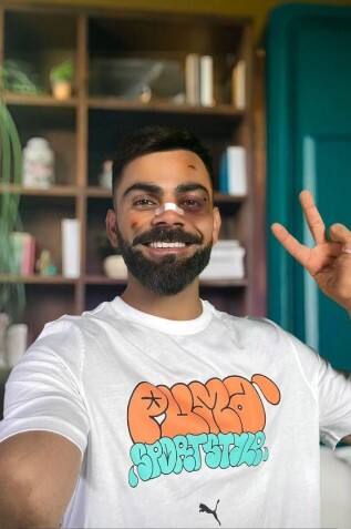 ਵਿਰਾਟ ਕੋਹਲੀ ਨੂੰ ਲੱਗੀਆਂ ਡੂੰਘੀਆਂ ਸੱਟਾਂ, ਜਾਣੋ ਸੱਚ