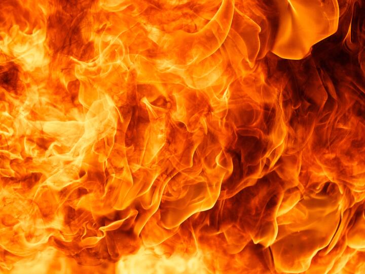 Telangana Karachi Bakery Fire Rangareddy 12 Injured In Fire Caused By Gas Pipeline Leak Telangana: 12 Injured In Fire Caused By Gas Pipeline Leak In Rangareddy