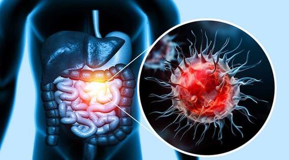 Health: This food destroys cancer cells, include it in your diet to avoid this deadly disease.