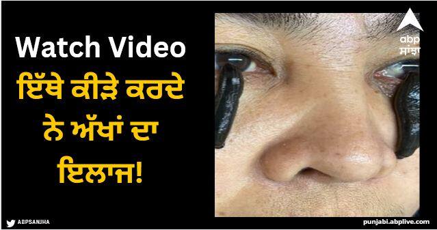 girudin vision recovery without any drugs leeches suck eyes to increase eyesight Viral Video: ਅੱਖਾਂ ਦੇ ਇਲਾਜ ਦਾ ਅਜਿਹਾ ਤਰੀਕਾ, ਆਈਡ੍ਰਾਪ ਤੋਂ ਬਿਨਾਂ ਤੇਜ਼ ਹੋ ਜਾਂਦੀ ਨਜ਼ਰ, ਕੀੜੇ ਚੱਟਦੇ ਨੇ ਪੁਤਲੀਆਂ