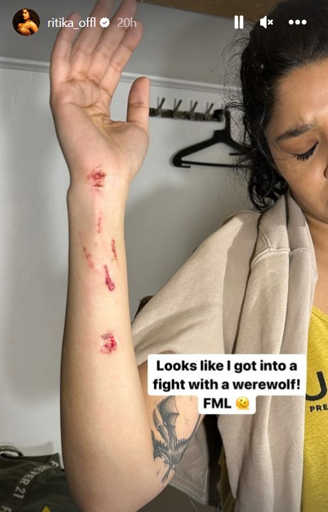 Ritika Singh Photos: शूटिंग के दौरान बुरी तरह घायल हुईं रजनीकांत की को स्टार, रितिका सिंह ने तस्वीरें शेयर कर बताया कैसा है हाल
