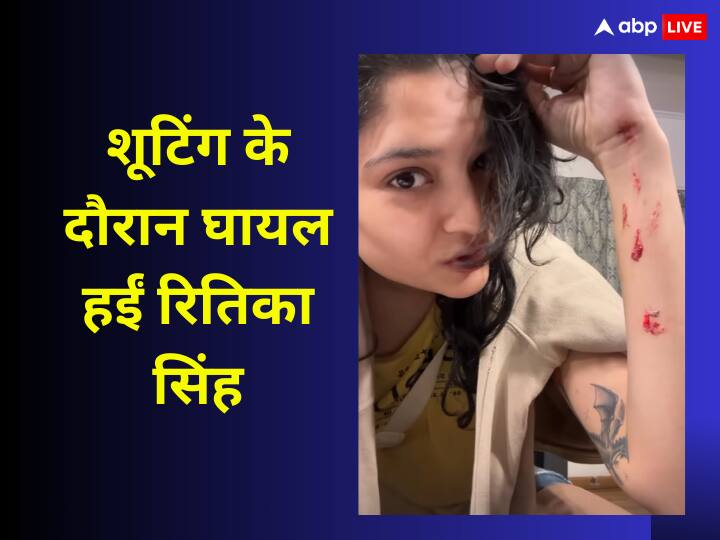Thalaivar 170 Rajinikanth costar Ritika Singh got injured during shooting actress shared pictures on instagram Ritika Singh Photos: शूटिंग के दौरान बुरी तरह घायल हुईं रजनीकांत की को स्टार, रितिका सिंह ने तस्वीरें शेयर कर बताया कैसा है हाल