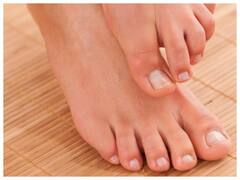 सर्दियों के मौसम में पैरों की उंगलियों में सूजन क्यों हो जाता है? जानें क्या करें घरेलू उपाय