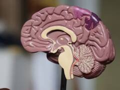 Brain Health : மூளையை மங்க செய்யும் மோசமான உணவுகள்!