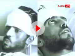 Video: देखें कितना खतरनाक होता है रेबीज, भेड़िया के काटने के बाद अजीब हरकत करने लगा था शख्स