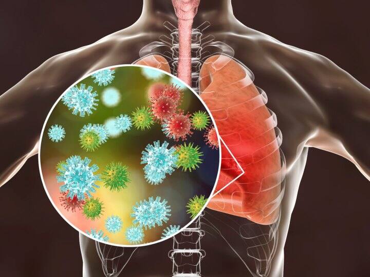 Pneumonia cases in AIIMS Delhi have no link with China Respiratory infections cases Pneumonia: ਏਮਜ਼ ਦਿੱਲੀ 'ਚ ਆਏ ਨਮੂਨੀਆ ਦੇ ਕੇਸਾਂ ਦਾ ਚੀਨ ਦੀ ਬਿਮਾਰੀ ਨਾਲ ਕੋਈ ਸਬੰਧ ਨਹੀਂ : ਸਿਹਤ ਮੰਤਰਾਲਾ