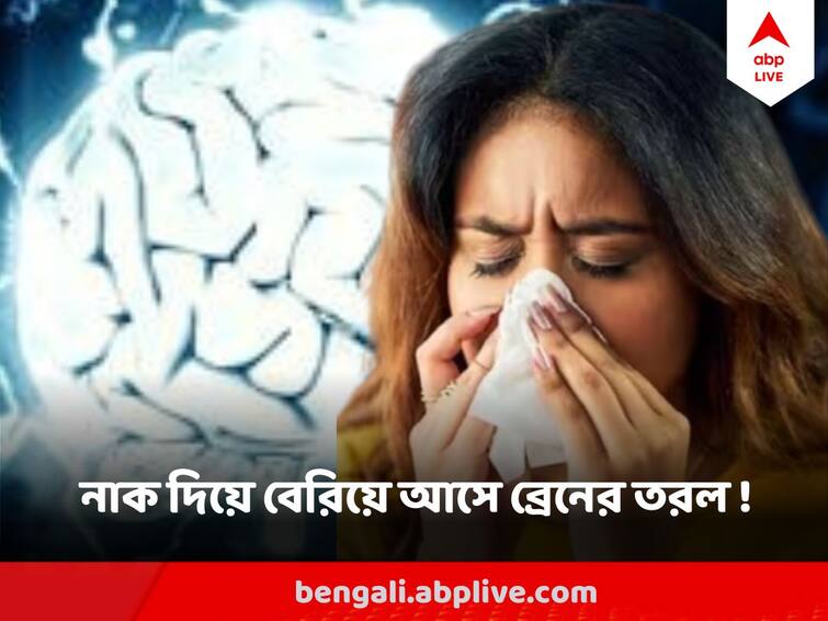 Runny nose always not caused by Cough and cold, may have underlying serious reason like Cerebrospinal fluid leak ABP Live Exclusive abpp Runny nose : নাক দিয়ে জল পড়া মানেই সর্দি নয় ! হতে পারে টিউমর বা মস্তিষ্কের বিশেষ অংশে ফাটলও