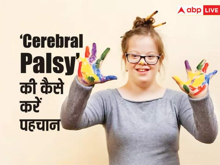 child health tips cerebral palsy causes symptoms risk factors and treatment in hindi जानें क्या है Cerebral Palsy बीमारी, बच्चों के लिए ये क्यों खतरनाक?