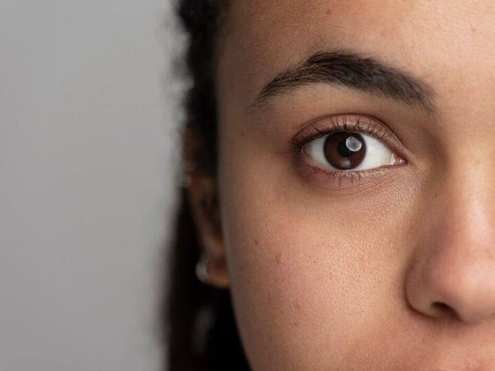 Get rid of dark circles under eyes just follow these simple home remedies आंखों के डार्क सर्कल को करें बॉय-बॉय, बस अपनाएं ये सरल घरेलू उपाय