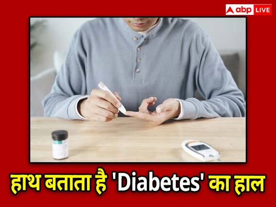 Diabetes : जब हाथों पर दिखने लग जाएं इस तरह के लक्षण, तो समझें इशारा, बढ़ रहा है ब्लड शुगर...