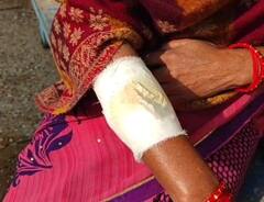 Delhi में तेंदुए के बाद फैला बंदर का आतंक, कई घायल, लोग घर में दुबकने को मजबूर