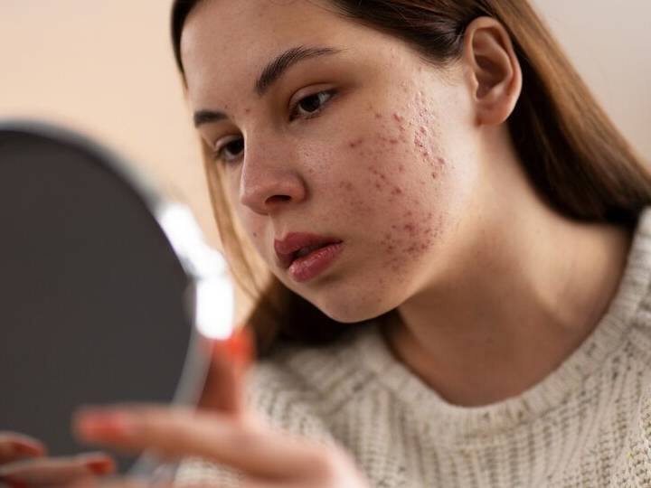 बॉडी पर हैं जो लाल रंग के डॉट, आखिर ये किस वजह से हो जाते हैं?