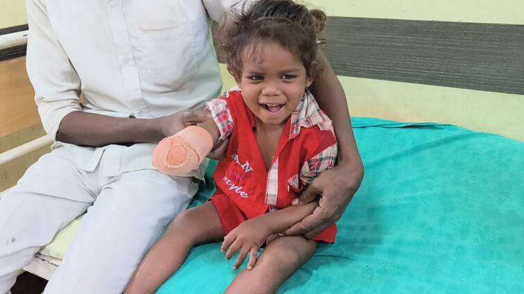 A 4-year-old child's hand had to be amputated due to doctor's negligence in Surat Civil Hospital Surat News: સુરત સિવિલ હોસ્પિટલમાં ડોક્ટરની બેદરકારીથી 4 વર્ષના બાળકનો હાથ કાપવો પડ્યો