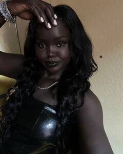 In Photos: इस लड़की ने सेट किए खूबसूरती के नए पैमाने, अपने अलग रंग से सबको बनाया दीवाना, देखें वायरल तस्वीरें