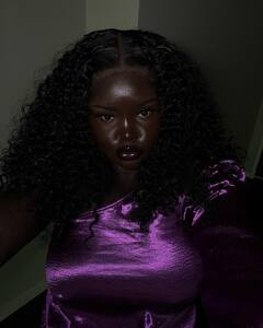 In Photos: इस लड़की ने सेट किए खूबसूरती के नए पैमाने, अपने अलग रंग से सबको बनाया दीवाना, देखें वायरल तस्वीरें