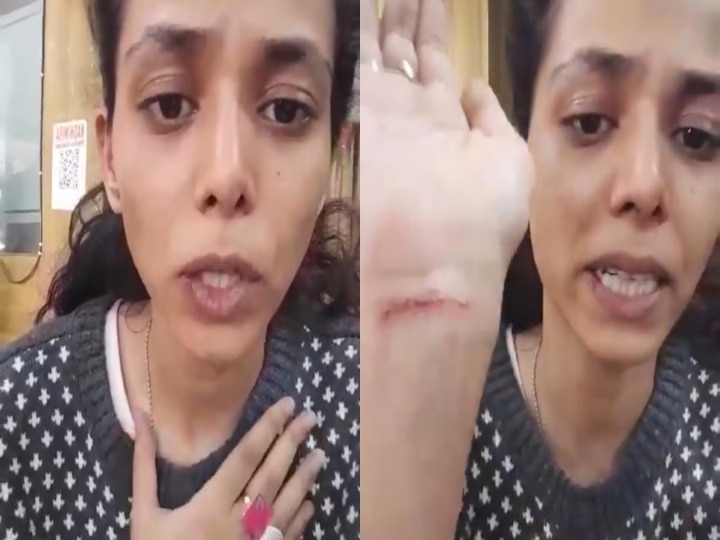 Watch Video : குடும்பத்தினரால் தாக்கப்பட்ட சிஐடி நடிகை... காயங்களுடன் வைஷ்ணவி தன்ராஜ் வெளியிட்ட வீடியோ  