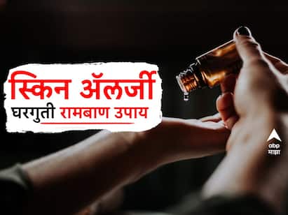 Skin Allergies : स्किन ॲलर्जीवर हे करा घरगुती उपाय!
