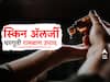 Skin Allergies : त्वचेवर झालेल्या ॲलर्जीने त्रस्त आहात, तर 'हे' घ्या घरगुती रामबाण उपाय...