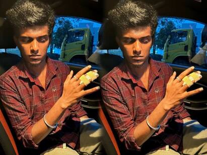 Vijay TV Fame KPY Bala shares his finger broken pictures on instagram KPY Bala: கண்ணு பட்டுருச்சு...சுத்திப்போடுங்க பாலா.. கைவிரல் உடைந்த KPY பாலா.. ஆறுதல் சொல்லும் நெட்டிசன்கள்..