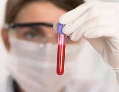 નવી વર્ષમાં આ ટેસ્ટ જરૂર કરાવો, અનેક બીમારીઓનું ટેન્શન થઇ જશે દૂર