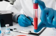 नवीन वर्षात 'या' तपासण्या करा, टेन्शनमुक्त व्हा!