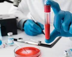 નવી વર્ષમાં આ ટેસ્ટ જરૂર કરાવો, અનેક બીમારીઓનું ટેન્શન થઇ જશે દૂર