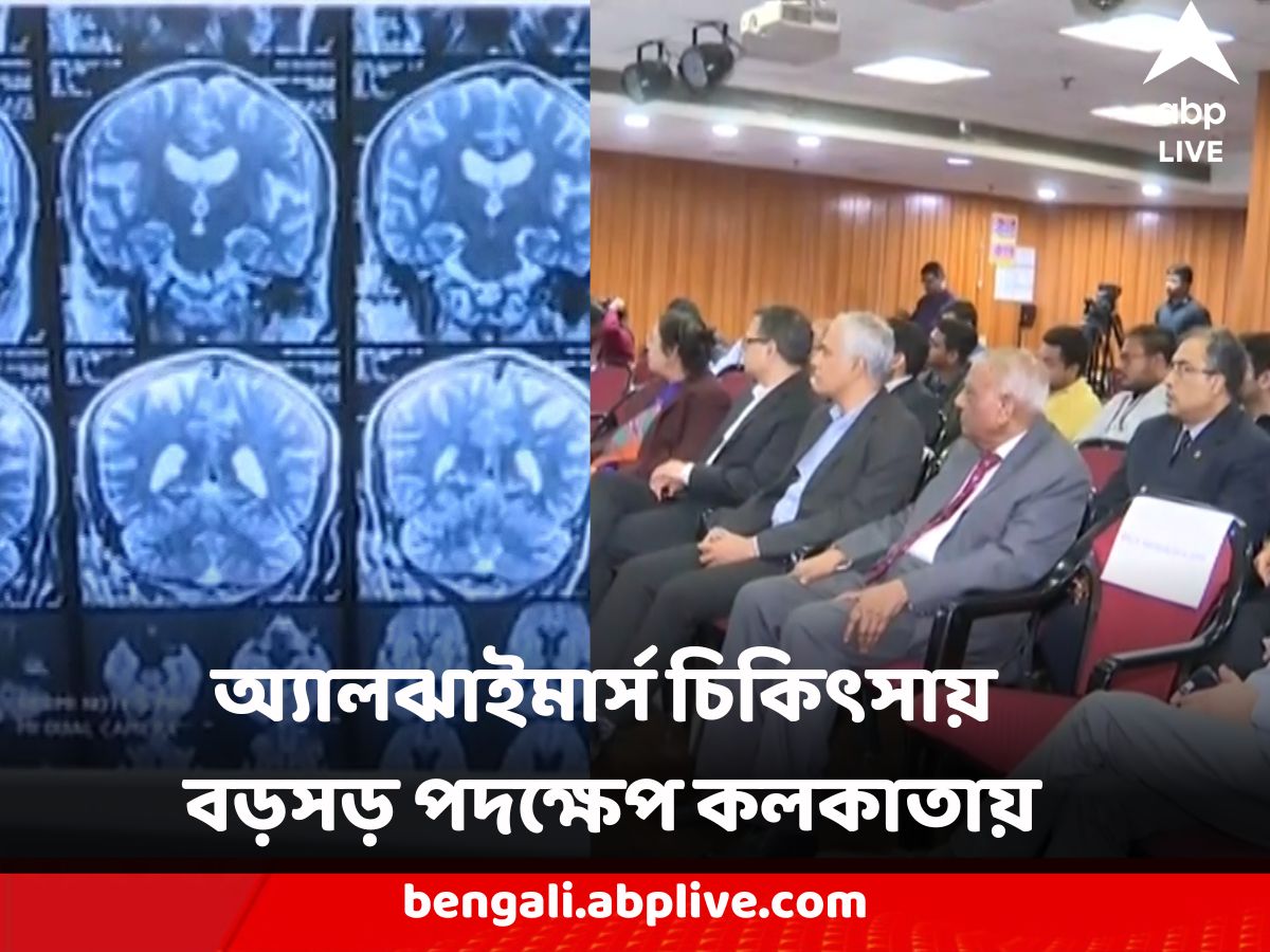 Alzheimer's Treatment : অ্যালঝাইমার্স চিকিৎসায় বড়সড় পদক্ষেপ, কলকাতার হাসপাতালে চালু অত্যাধুনিক পরীক্ষা সিএসএফ বায়োমার্কার টেস্টিং