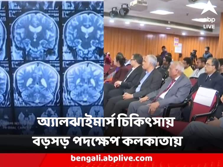 Alzheimer's Treatment State of the Art CSF Bio Marker Testing Started in Kolkata Hospital institute of neurosciences Alzheimer's Treatment : অ্যালঝাইমার্স চিকিৎসায় বড়সড় পদক্ষেপ, কলকাতার হাসপাতালে চালু অত্যাধুনিক পরীক্ষা সিএসএফ বায়োমার্কার টেস্টিং