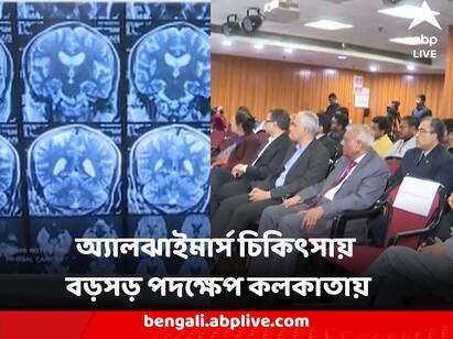 Alzheimers Treatment State of the Art CSF Bio Marker Testing Started in Kolkata Hospital institute of neurosciences Alzheimers Treatment : অ্যালঝাইমার্স চিকিৎসায় বড়সড় পদক্ষেপ, কলকাতার হাসপাতালে চালু অত্যাধুনিক পরীক্ষা সিএসএফ বায়োমার্কার টেস্টিং