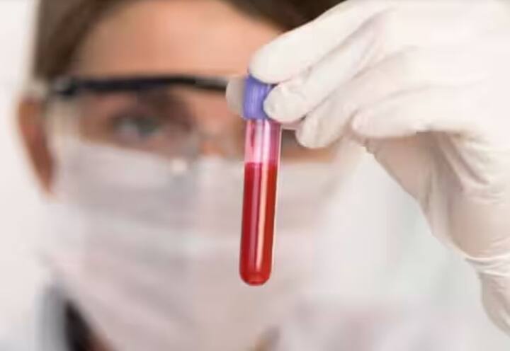 चाचणी केल्यामुळं आजार वाढण्यापूर्वी तुम्हाला सतर्क केले जाईल. त्यामुळं तुम्हाला काळजी घेणं सोपं होईल.