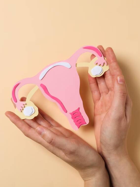 क्या होता है पीसीओडी? क्या यह लाइफटाइम रहता है