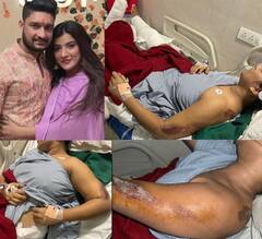 Priya Singh: ਬੁਆਏਫ੍ਰੈਂਡ ਨੇ ਸੋਸ਼ਲ ਮੀਡੀਆ Influencer ਪ੍ਰਿਆ ਸਿੰਘ ਦਾ ਕੀਤਾ ਬੁਰਾ ਹਾਲ, ਜਾਣੋ ਕਿਉਂ ਗ੍ਰਿਫਤਾਰ ਨਹੀਂ ਹੋਏ ਮੁਲਜ਼ਮ