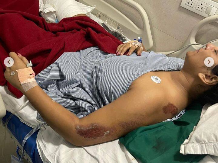 महाराष्ट्र से खबर आई है कि 26 साल की इंस्टाग्राम इनफ्लुएंसर को उन्हीं के बॉयफ्रेंड ने कार से कुचलने की कोशिश की है. इस हादसे में माॅडल बुरी तरह जख़्मी हुईं है. सोशल मीडियी पर उनकी तस्वीरें खूब वायरल हो रही हैं.