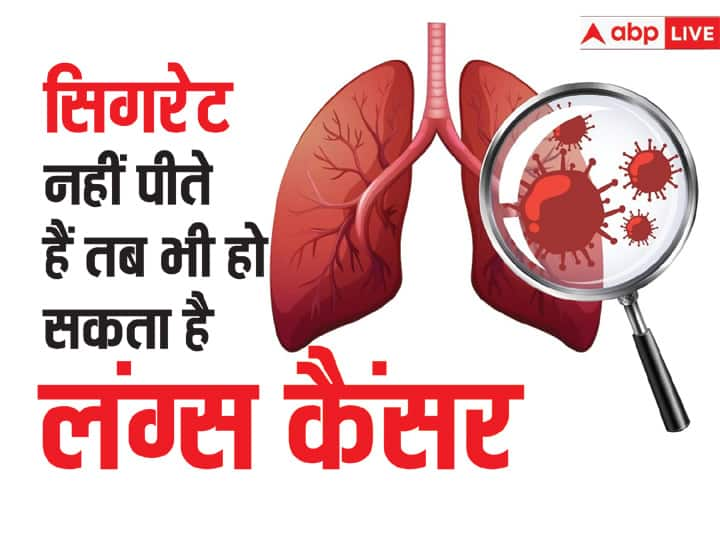 Lung cancer risk in never smokers An overview of environmental and genetic factors Non Smokers Lung Cancer: सिगरेट ना पीने वाले लोगों को भी हो सकता है लंग कैंसर, ये है सबसे बड़ा रिस्क फैक्टर्स