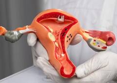 महिलांनो, वेळीच तुमच्या वैयक्तिक स्वच्छतेची काळजी घ्या; अन्यथा 'या' गंभीर आजारांचा वाढता धोका; वाचा तज्ज्ञांचं म्हणणं