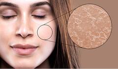 Chickoo Benefits: પોષક તત્વથી ભરપૂર આ ફળ કોલેજન બૂસ્ટ કરતું હોવાથી સેવનથી સ્કિન રહે છે એવરયંગ