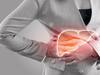 Liver Cancer Risk Factors : కాలేయ క్యాన్సర్​కు ప్రధాన కారకాలు ఇవే.. మధుమేహమున్నవారు తస్మాత్ జాగ్రత్త