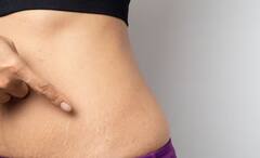 Health Tips: সাত তাড়াতাড়ি রোগা হতে গিয়ে আলগা হয়ে যাচ্ছে চামড়া? সমাধান রয়েছে হাতের কাছেই