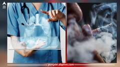 Lung Cancer: ਸਿਗਰਟ ਨਾ ਪੀਣ ਵਾਲਿਆਂ ਵਿੱਚ ਵੀ ਫੇਫੜਿਆਂ ਦੇ ਕੈਂਸਰ ਦਾ ਖ਼ਤਰਾ