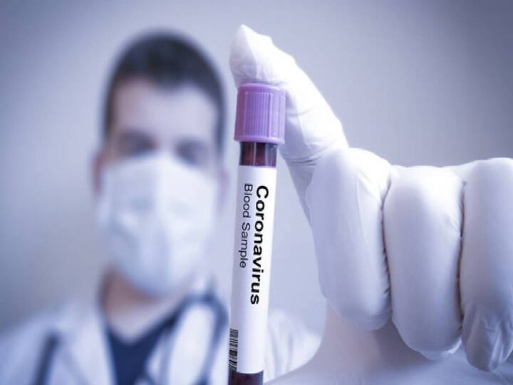 In Tamil Nadu, 4 people have been confirmed to be infected with the mutated corona virus  JN.1 Variant total of 63 in india Corona JN.1 Variant: தமிழ்நாட்டில் 4 பேருக்கு புதிய வகை கொரோனா.. இந்தியாவில் இதுவரை 63 பேருக்கு பாதிப்பு..