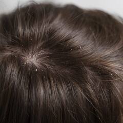 Hair Care Tips: ਸਰਦੀਆਂ 'ਚ ਇੰਝ ਕਰੋ ਵਾਲਾਂ ਦੀ ਦੇਖਭਾਲ