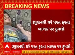 Anand Dog Issue | આણંદના ઉમરેઠમાં 8 વર્ષીય બાળક પર 5 શ્વાનોએ કરી દીધો હુમલો