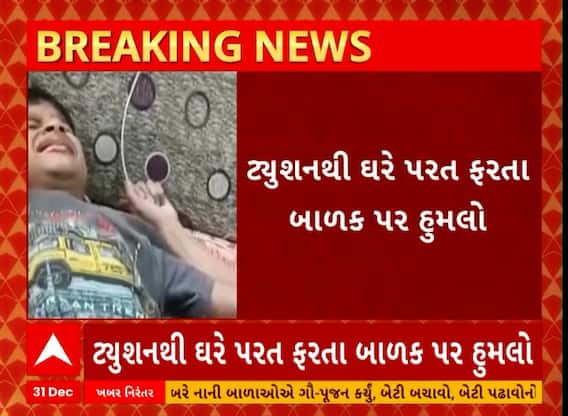 Anand Dog Issue | આણંદના ઉમરેઠમાં 8 વર્ષીય બાળક પર 5 શ્વાનોએ કરી દીધો હુમલો