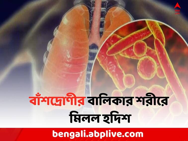 China pneumonia bacteria found in Kolkata China Pneumonia In Kolkata: চিনের নিউমোনিয়ার ব্যাকটেরিয়ার হদিশ এবার কলকাতায়!