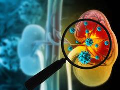 Kidney Health : சிறுநீரகத்தில் தங்கியுள்ள நச்சுக்களை நீக்க இந்த பழங்களை உண்ணுங்கள்!